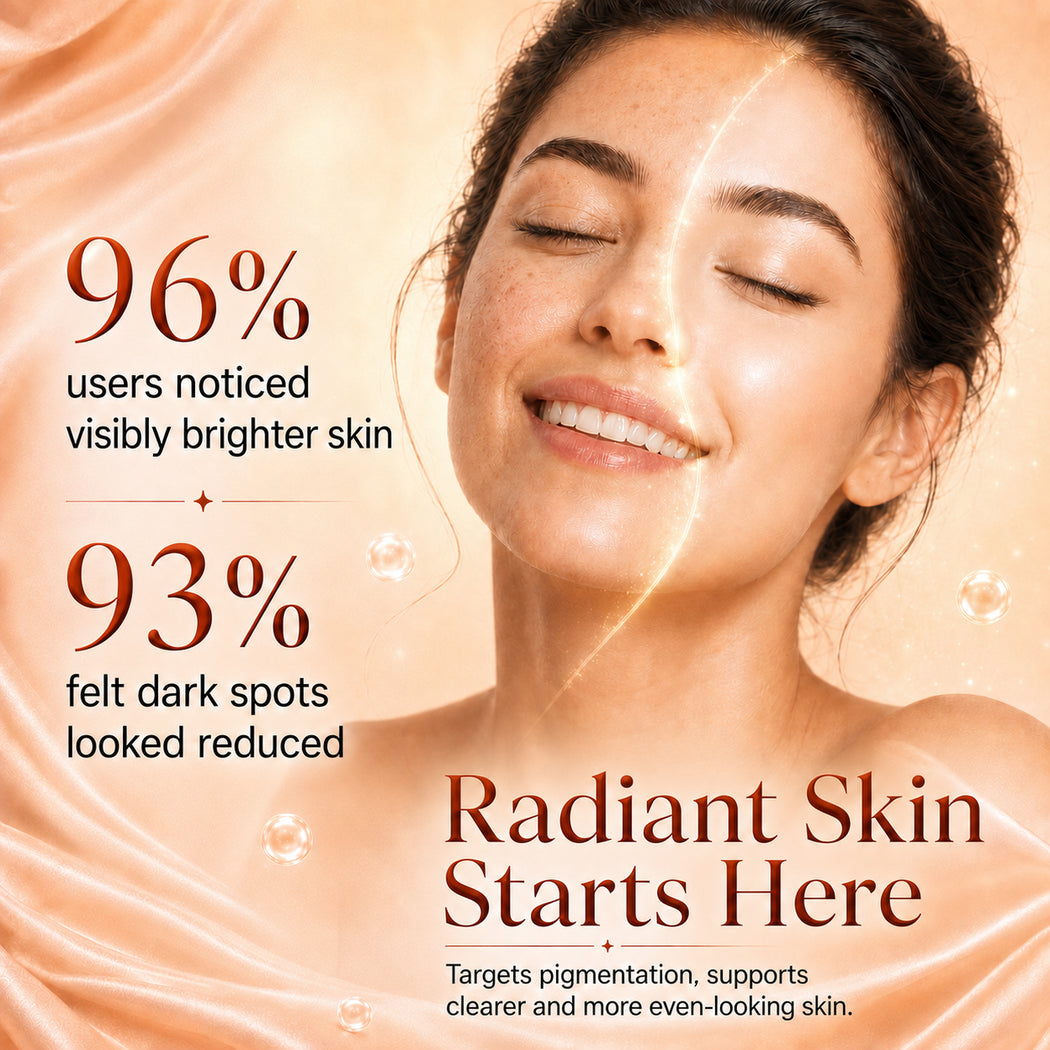 3%Tranexamic and 10% Azelaic Acid Anti Pigmentation Serum with 5% Niacinamide| Brighter Complexion| Reduces Dark Spots| Soothes Inflammation|Fades Hyper pigmentation| For All Skin Types| (30 ml / 1.02 fl.oz)